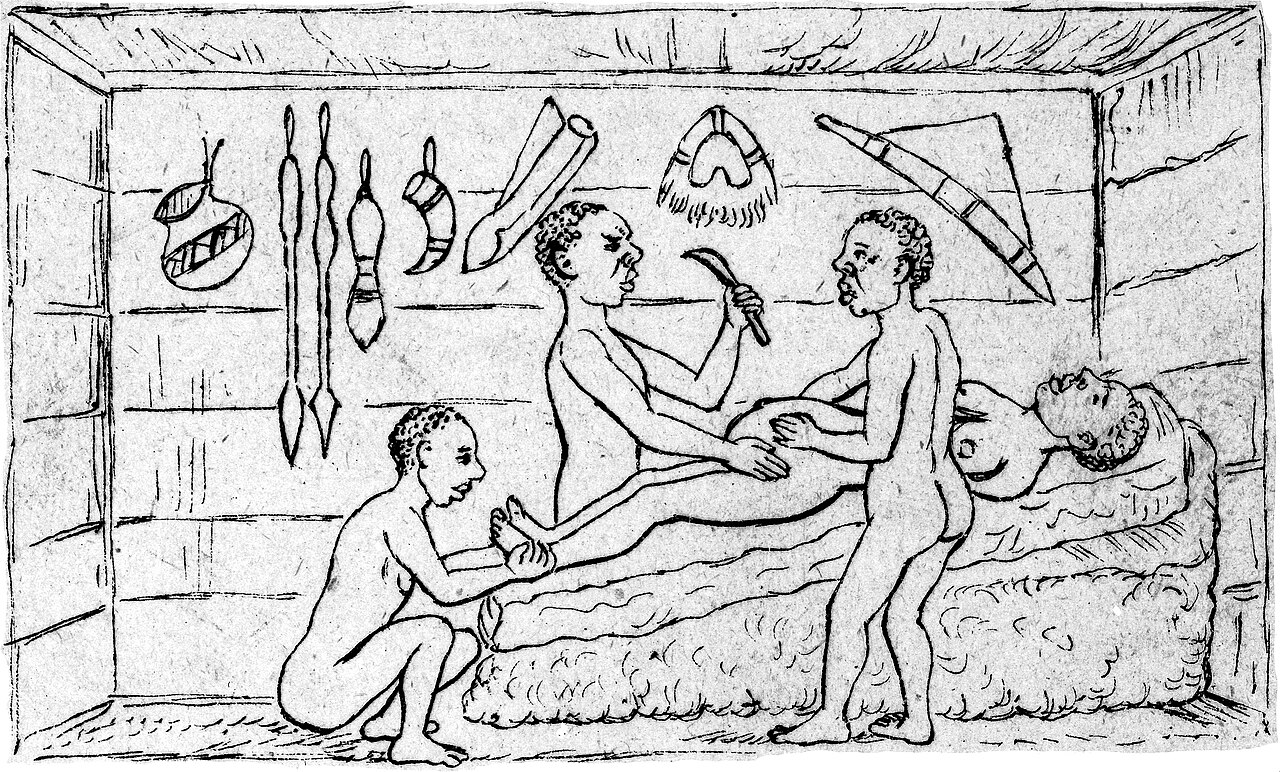 Old drawing showing doctors helping a mother in Uganda.