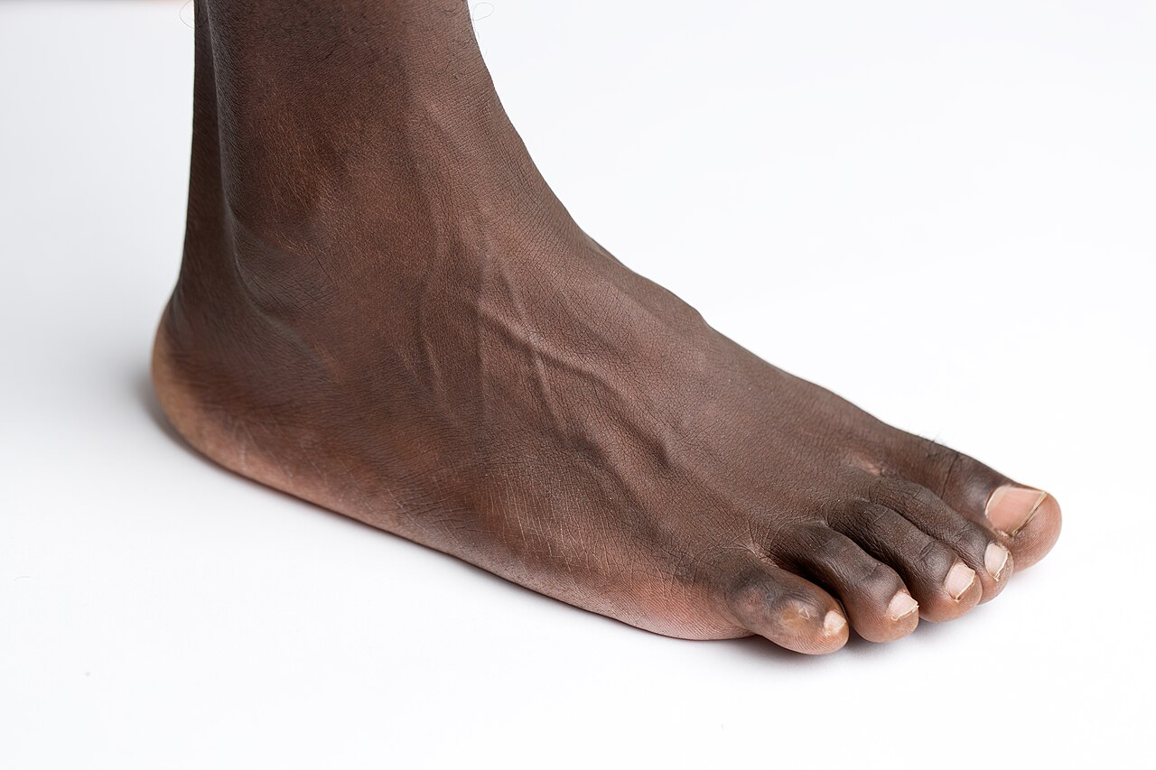 Feet
