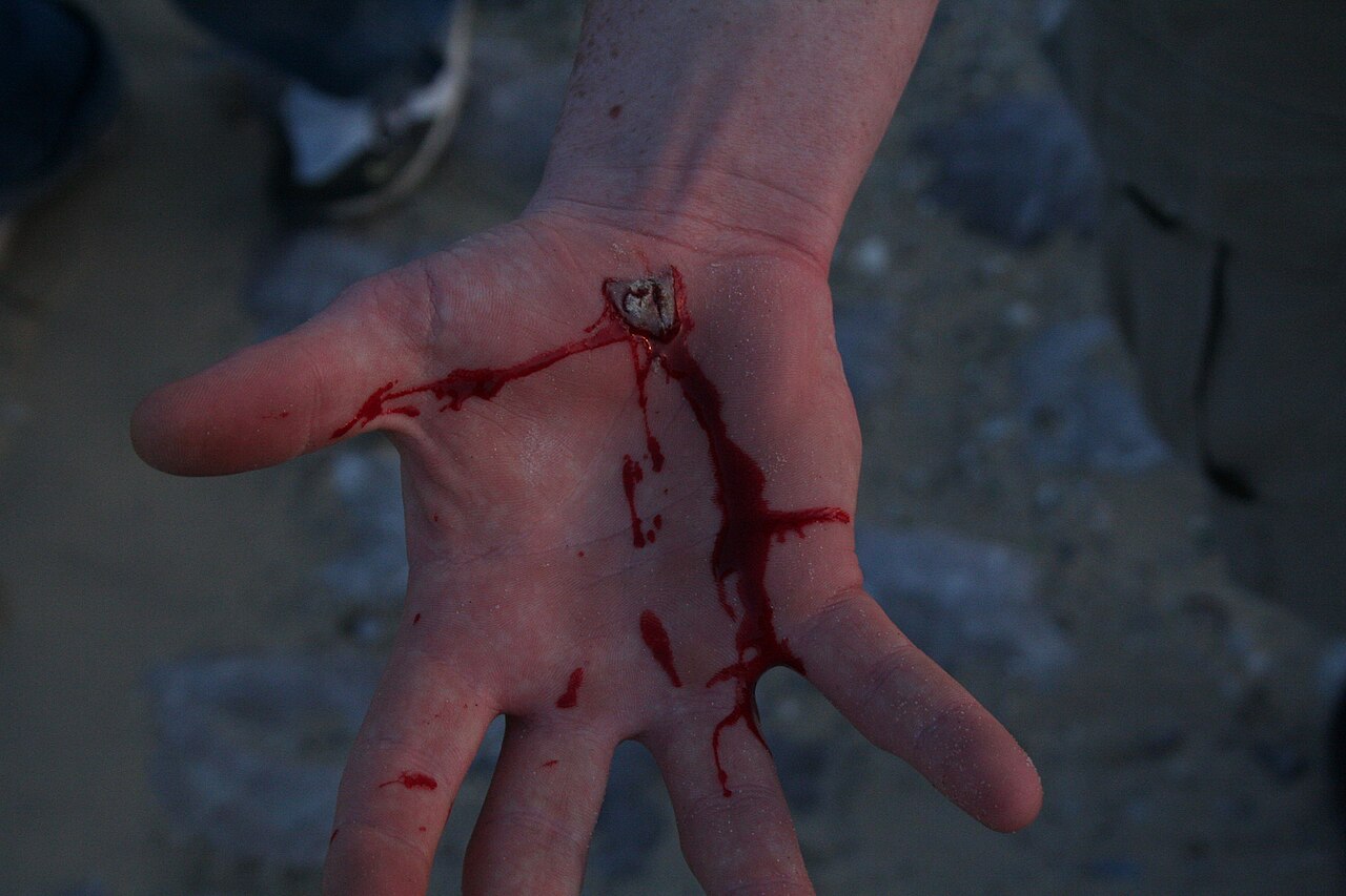 A skateboarder takes a fall and scrapes his hand.