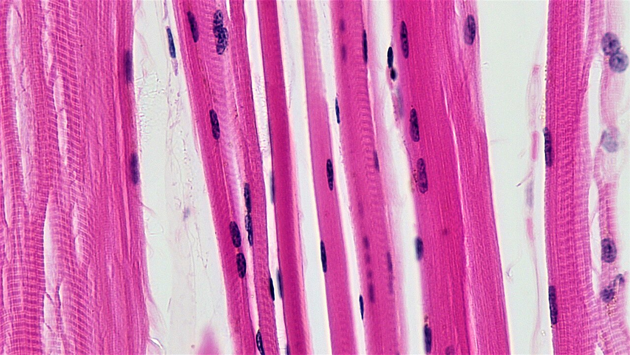Tiny muscle fibers seen up close through a microscope.