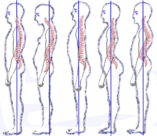 Posture