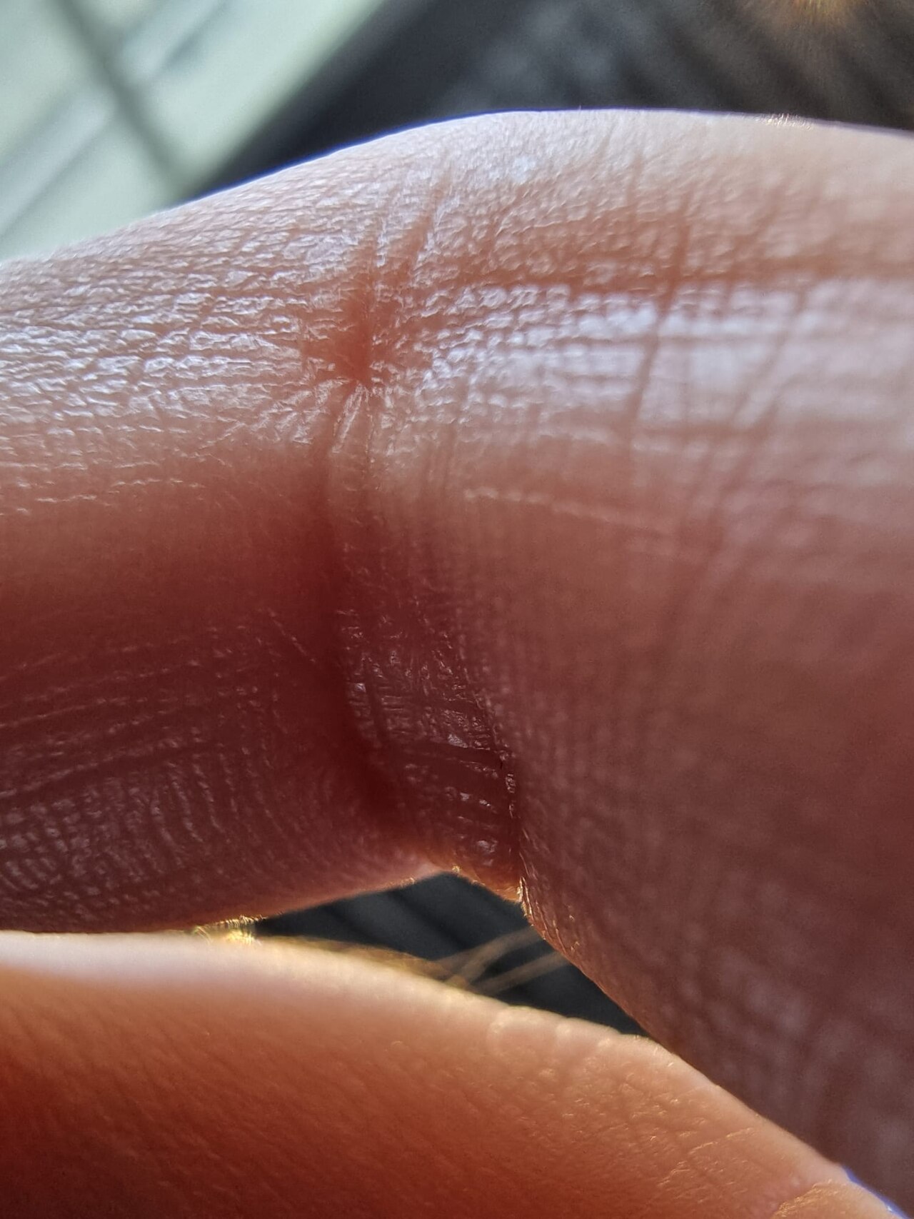 The tiny lines and swirls on human skin.