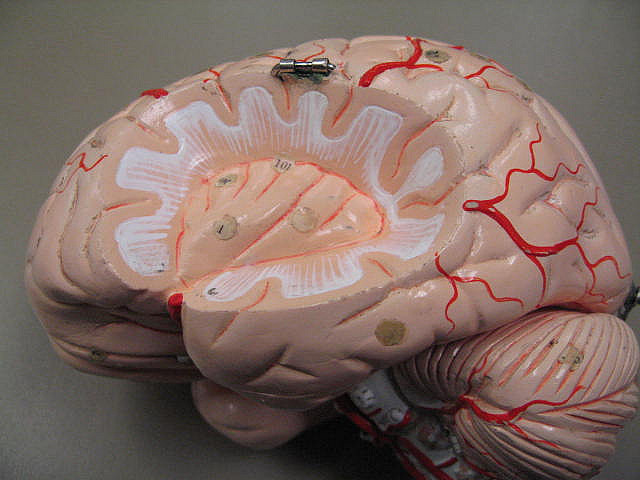 A colorful picture showing a hidden part of the brain.