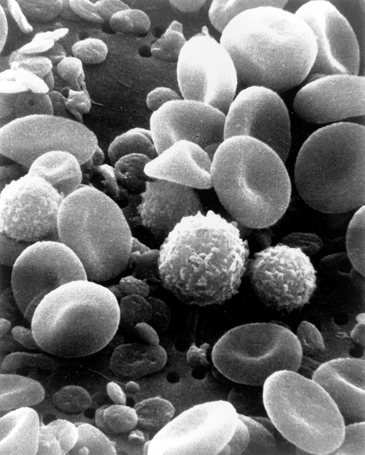 Red and white blood cells seen up close through a microscope.