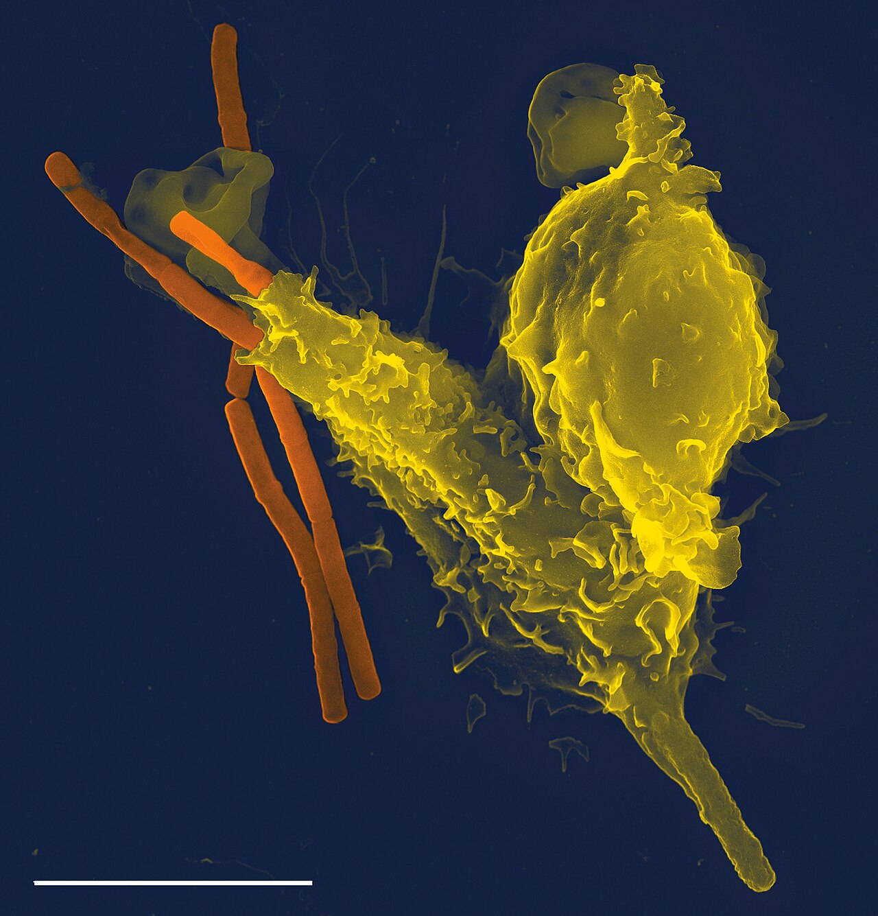 The Immune System
