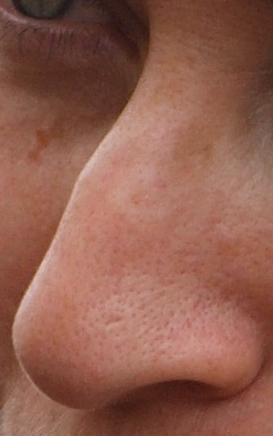 The Nose