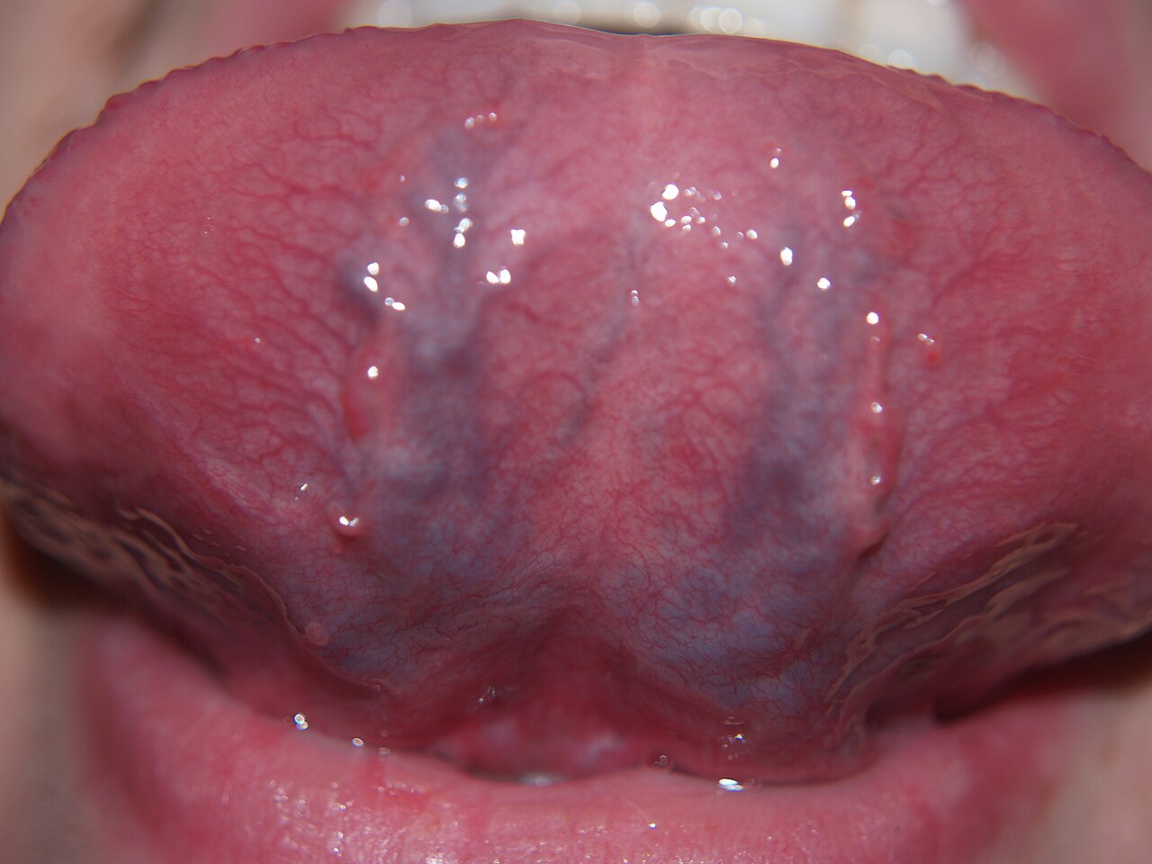 A close-up photo of the underside of a human tongue.