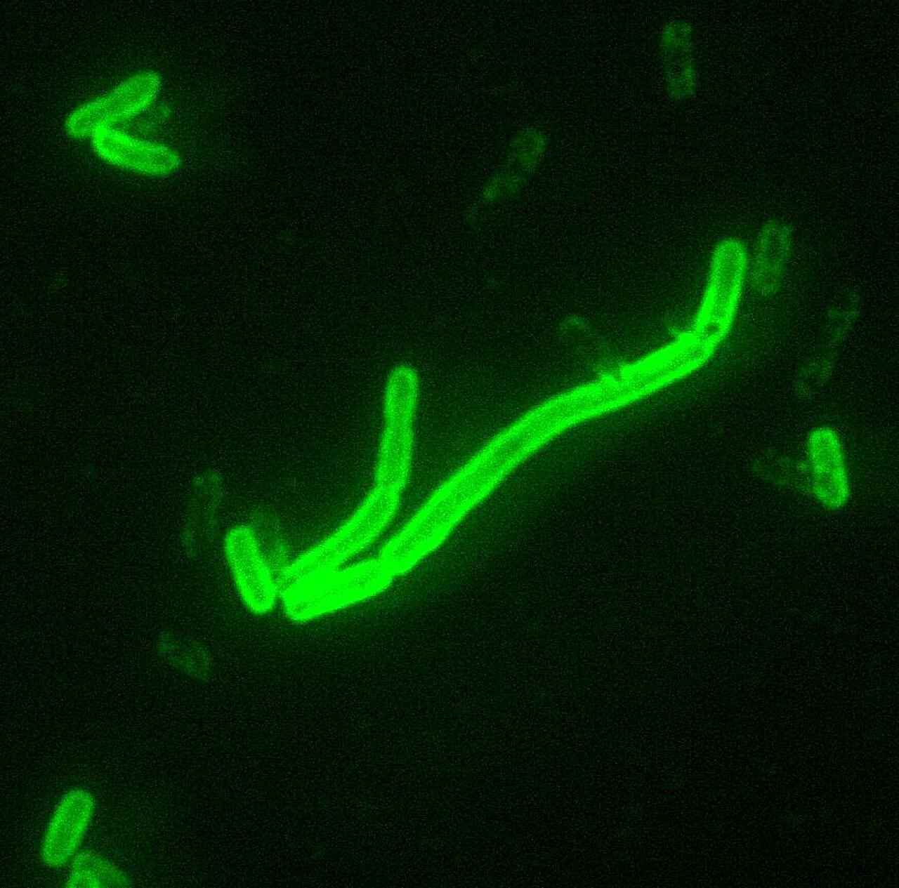 Tiny germs under a microscope that caused the Black Death sickness.