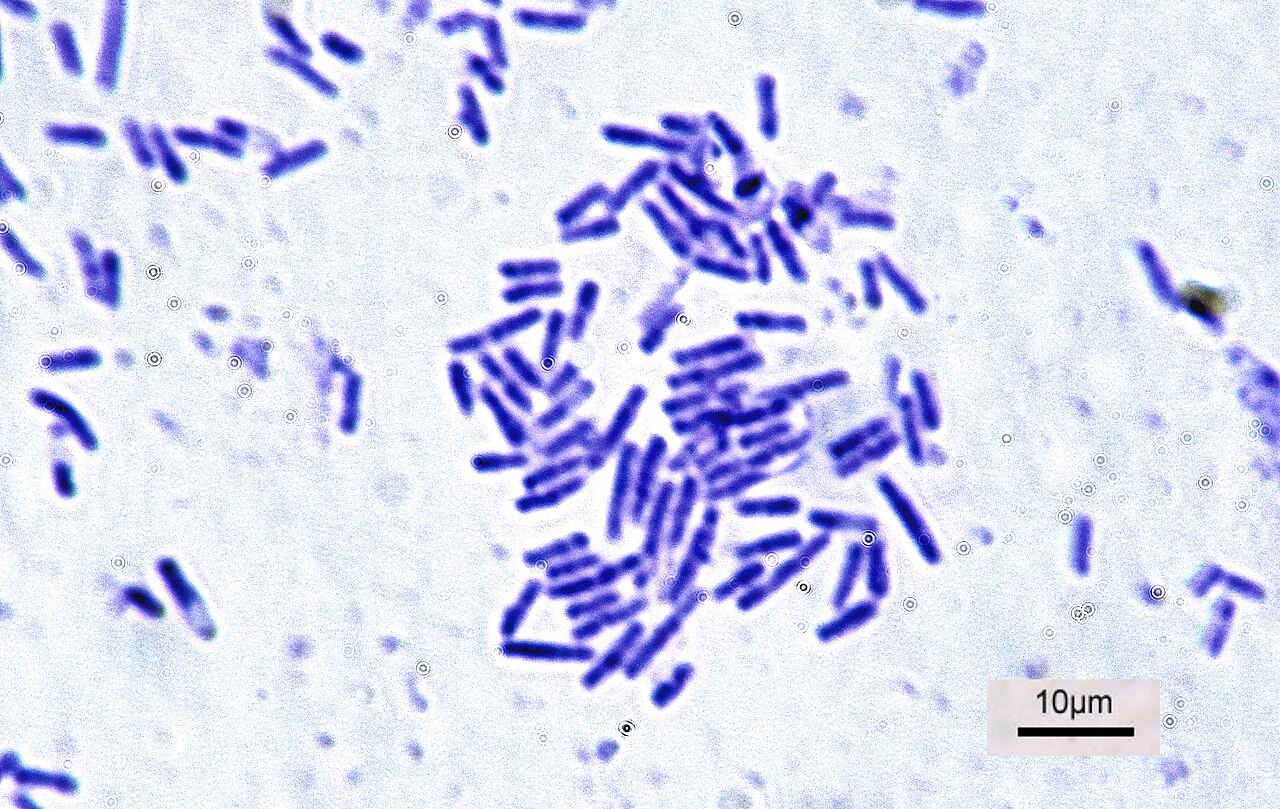 Tiny purple rod-shaped bacteria seen through a microscope.