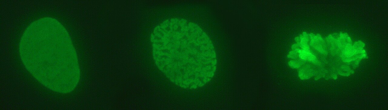 Glowing green chromosomes inside cells getting ready to split.