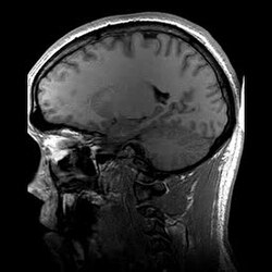 MRI Machines